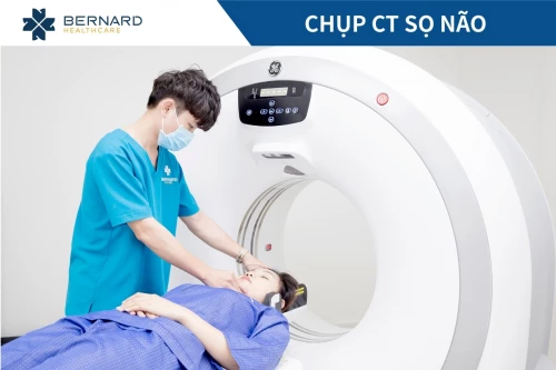 Chụp CT sọ não